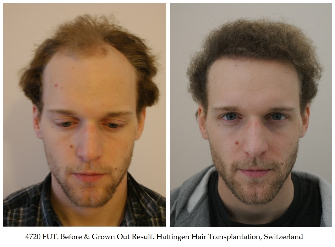 Волосы форум мужчины. [Original] body transplant фф.